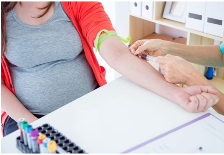 Có cần nhịn ăn trước khi làm Double test không?