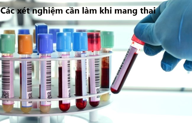 Xét nghiệm mẹ bầu cần làm khi mang thai