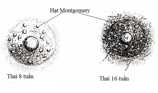 Hạt Montgomery và sự xuất hiện của những hạt trắng ở đầu vú
