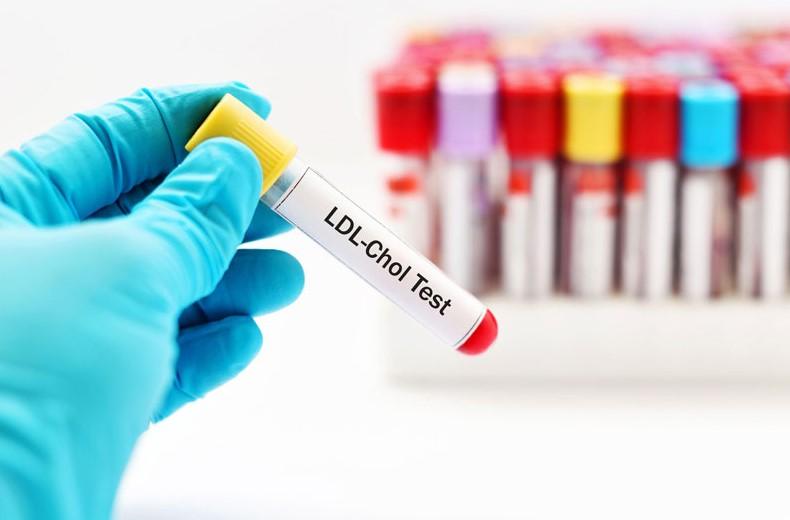 Ý nghĩa của chỉ số LDL trong máu – Phòng khám 43 Nguyễn Khang