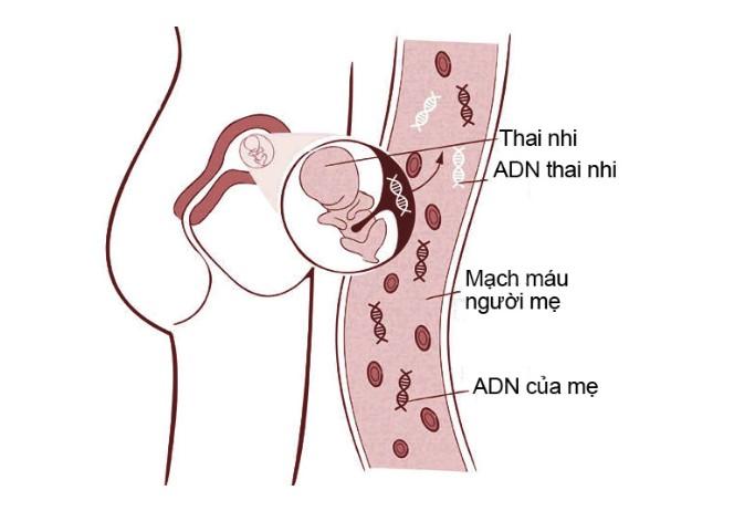 Double test nguy cơ cao, mẹ bầu có cần làm NIPT không?