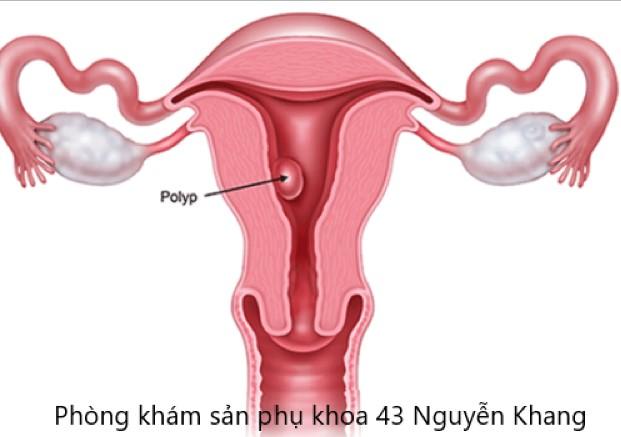 Cách đặt thuốc polygynax cho bà bầu