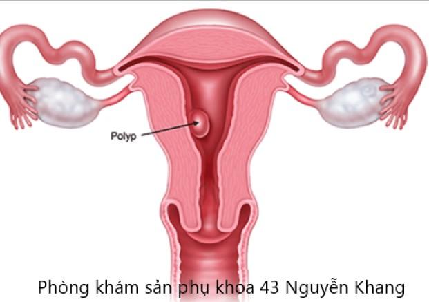 Cách đặt thuốc polygynax cho bà bầu