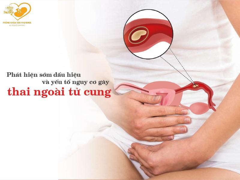 Siêu âm chưa thấy thai thì liệu có phải chửa ngoài tử cung?