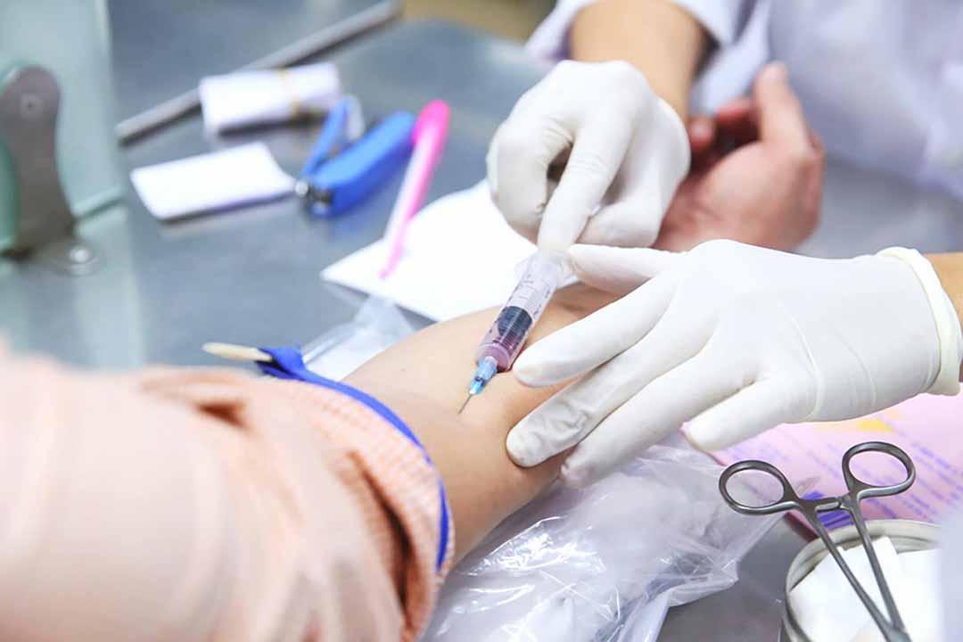 Xét nghiệm máu để làm gì?