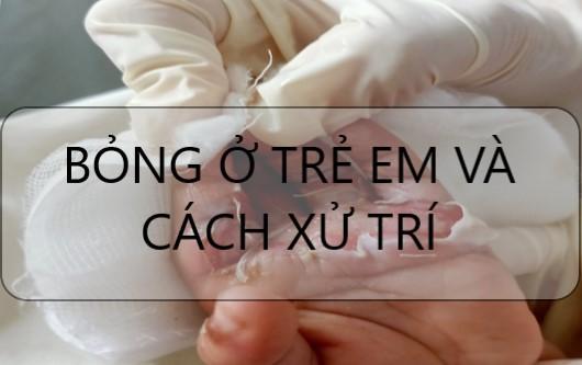Bỏng ở trẻ em và cách xử trí