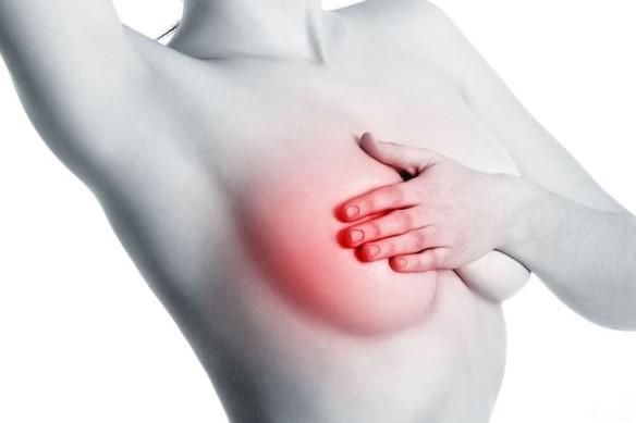 Tắc tia sữa sau sinh