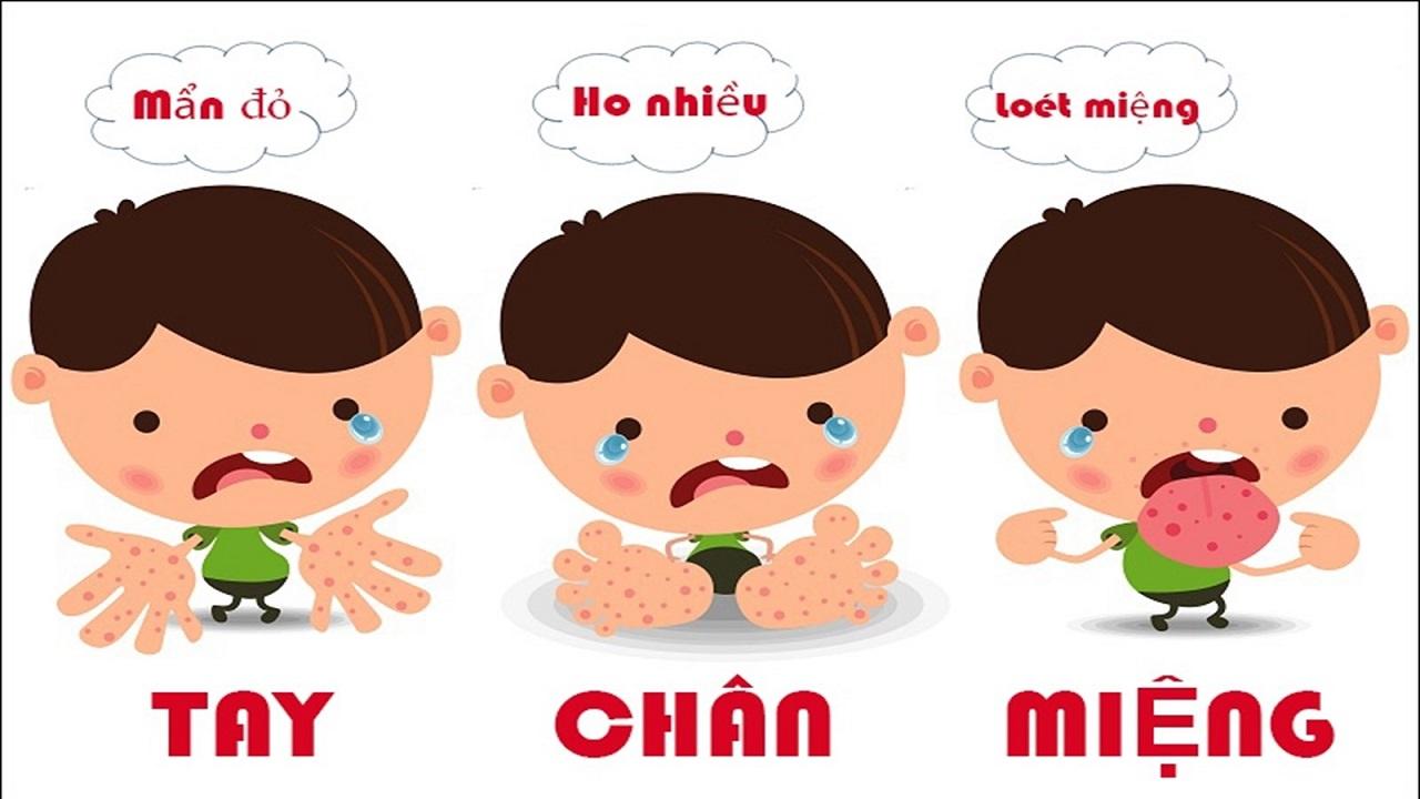 Bệnh tay chân miệng ở trẻ em