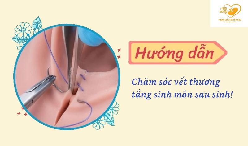 chăm sóc vết khâu tầng sinh môn