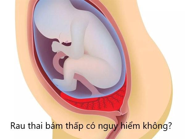 Rau bám thấp có nguy hiểm không?