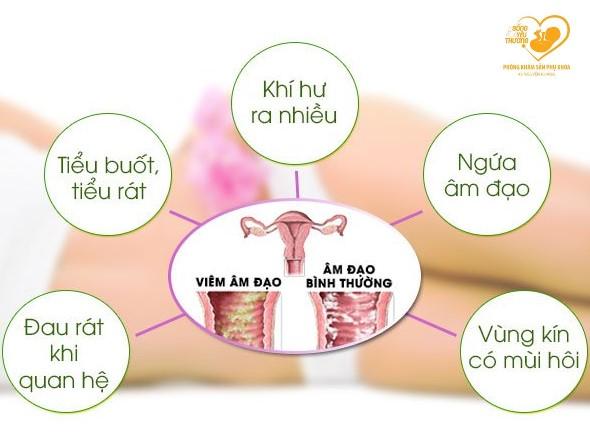 Cảnh báo 5 dấu hiệu viêm âm đạo bạn cần biết