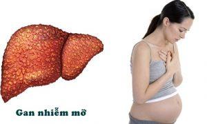 Gan nhiễm mỡ khi mang thai và biến chứng mẹ bầu cần biết