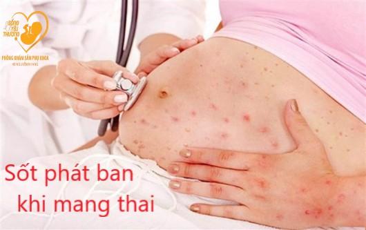 Sốt phát ban khi mang thai