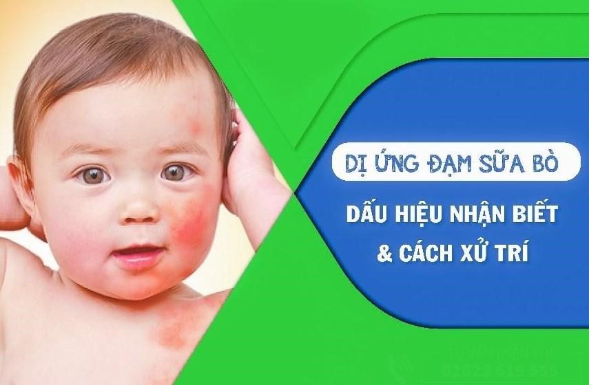 Cách nhận biết và xử lí trẻ bị dị ứng đạm sữa bò