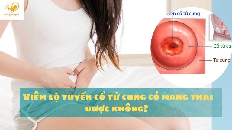 Bị viêm lộ tuyến cổ tử cung có mang thai được không?