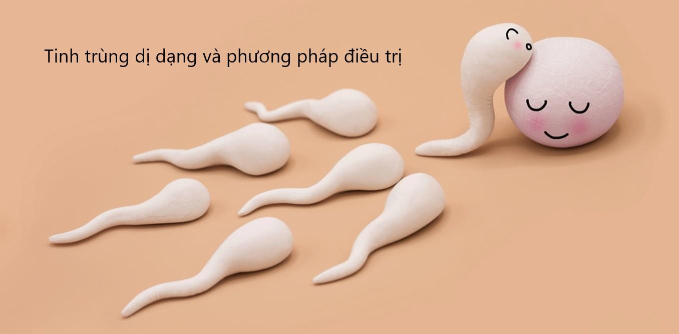 Tinh trùng dị dạng là gì và hướng điều trị ra sao?