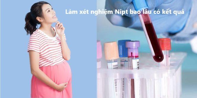 Làm xét nghiệm Nipt bao lâu có kết quả?