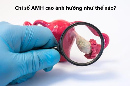 Chỉ số AMH cao có sao không?