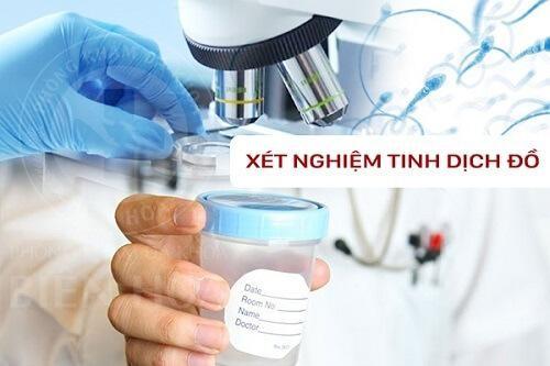 Cần lưu ý gì trước khi làm xét nghiệm tinh dịch đồ?