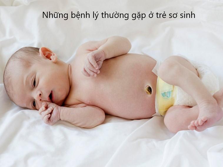 Các bệnh lý thường gặp ở trẻ sơ sinh phần 1