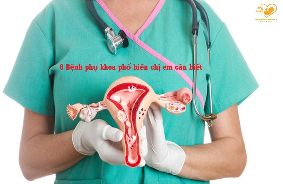 6 Bệnh phụ khoa phổ biến chị em phụ nữ nên biết