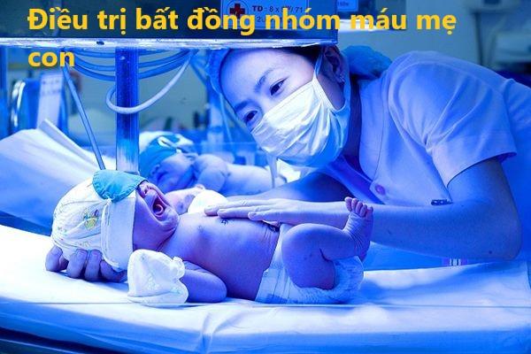 2 Phương pháp điều trị đặc hiệu bất đồng nhóm máu mẹ con