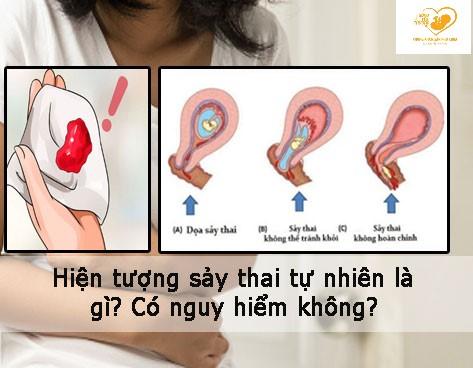 Sẩy thai tự nhiên nguy hiểm như thế nào?