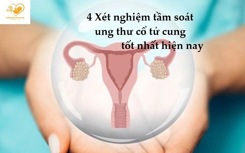 4 Xét nghiệm tầm soát ung thư cổ tử cung bạn nên biết