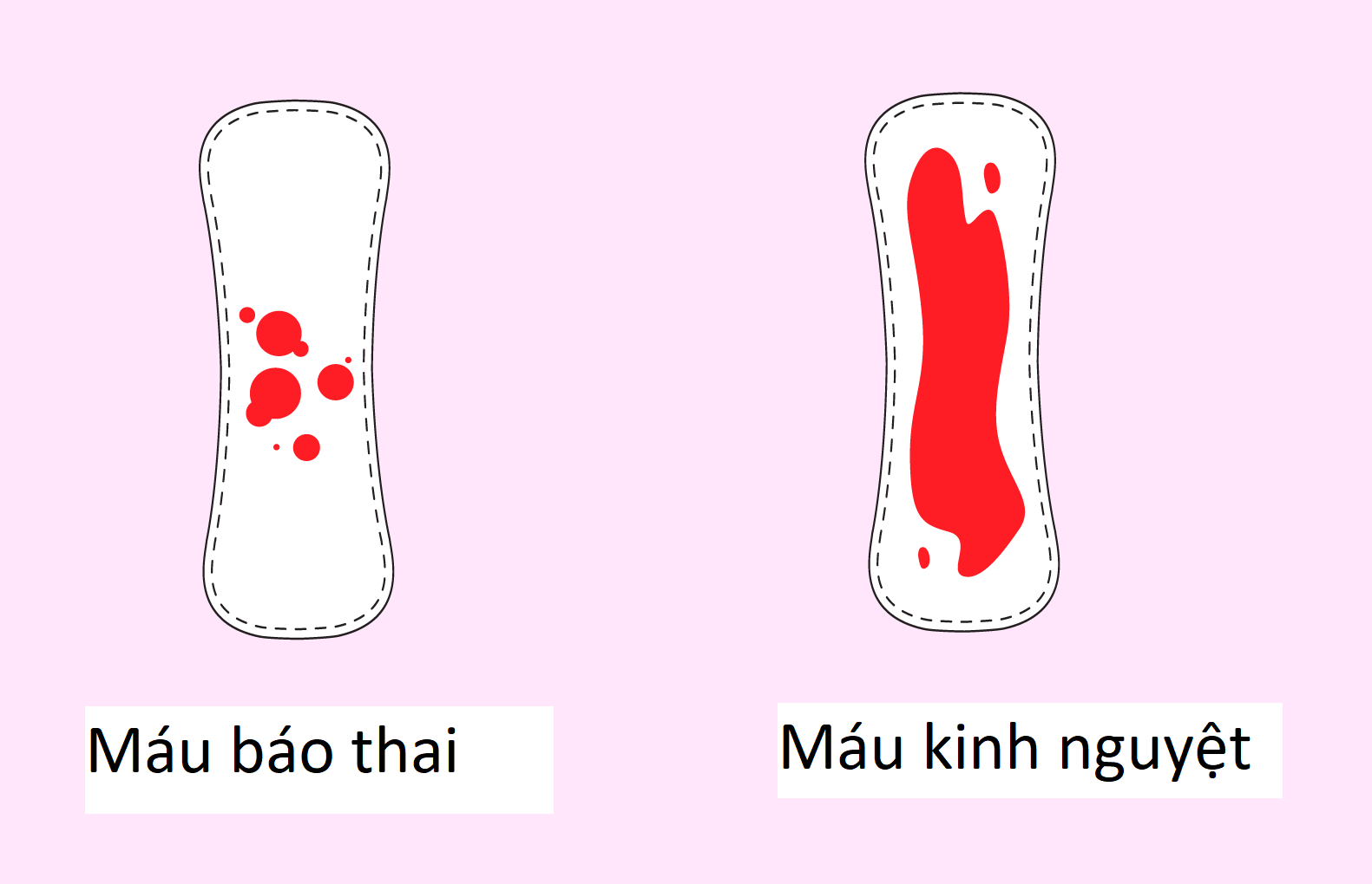 Máu báo thai - Dấu hiệu phôi làm tổ thành công