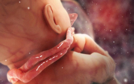 Dây rốn quấn cổ 2 vòng, sinh thường liệu có nguy hiểm?
