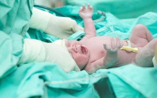 Hội chứng hít nước ối phân su ở trẻ sơ sinh - những điều mẹ cần biết
