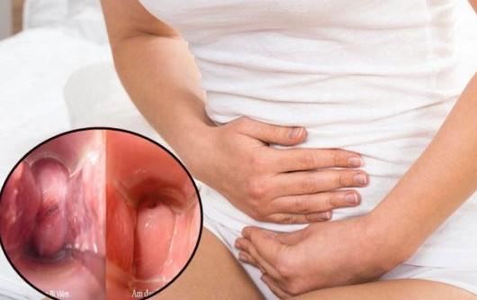 Nguyên nhân gây ra các bệnh phụ khoa thường gặp