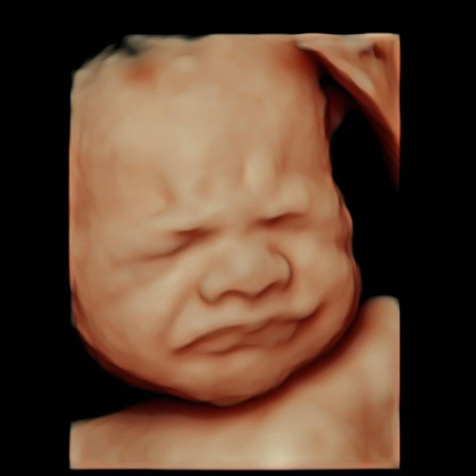 Cảnh báo: Đừng để cơn giận của mẹ làm đau bé yêu trong bụng!