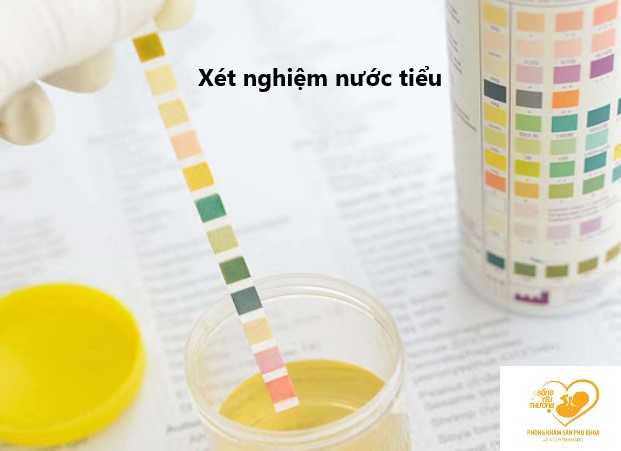 xét nghiệm nước tiểu