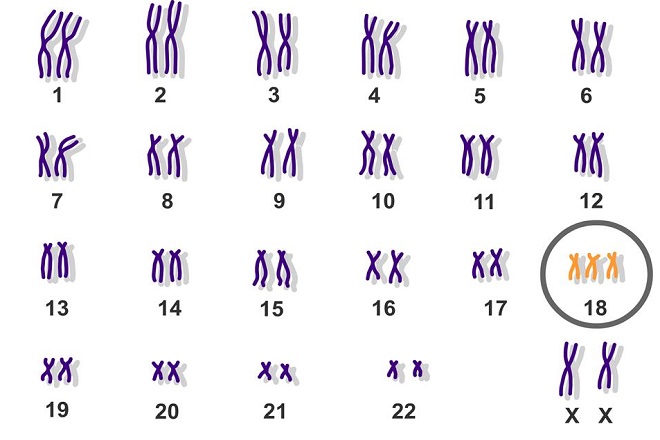 Xét nghiệm Triple test tầm soát dị tật thai nhi,