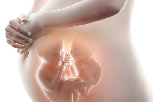 đa thai là một trong những yếu tố làm tăng tình trạng ốm nghén