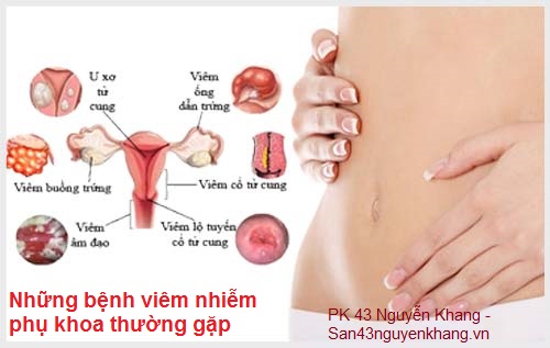 Những bệnh viêm nhiễm phụ khoa thường gặp?