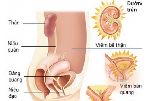 Khi mang thai bị viêm đường tiết niệu thì phải làm sao?