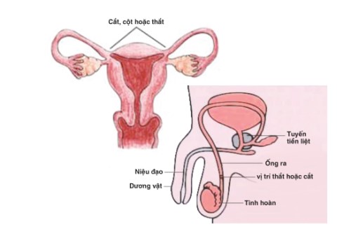 tất tần tật về các biện pháp tránh thai