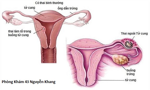 đau bụng dấu hiệu nguy hiểm