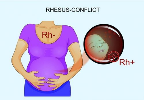 Bất đồng nhóm máu Rh giữa mẹ và con