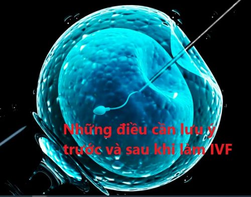 Những điều cần lưu ý trước và sau khi làm IVF