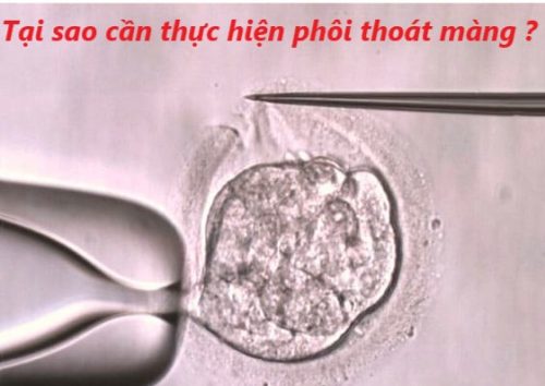 Tại sao cần thực hiện kĩ thuật phôi thoát màng