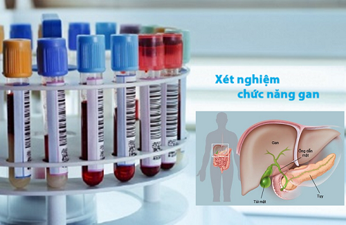 Những xét nghiệm chức năng gan thông thường