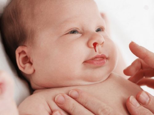 Xuất huyết giảm tiểu cầu vô căn