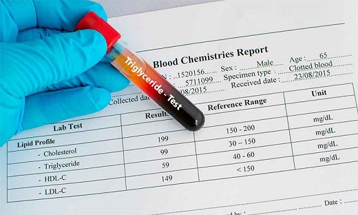 Chỉ số Triglyceride trong máu là gì?
