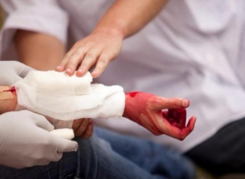Những bệnh nhân chảy máu không do giảm tiểu cầu được chống chỉ định truyền tiểu cầu