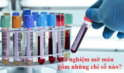 Xét nghiệm mỡ máu gồm những chỉ số nào?
