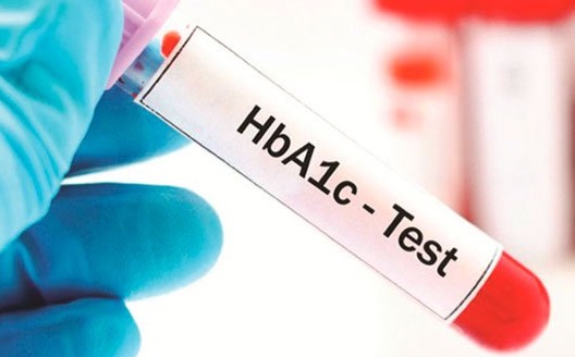 Chỉ số HbA1c là gì?