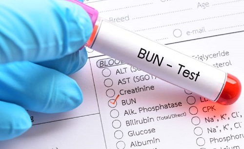 Tìm hiểu về chỉ số ure máu